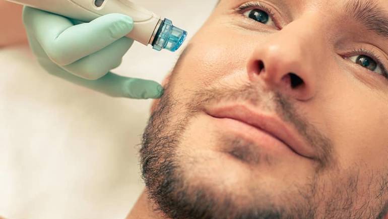 MICRONEEDLING - Soin Visage Amandi Nails