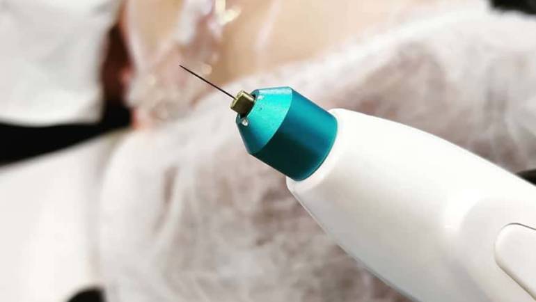 Soin du visage - Plasma Lift par Amandi Nails Le Roeulx